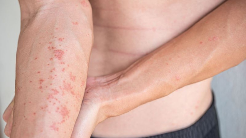 nuoc nhiem phen la gi tac hai cua nuoc nhiem phen voi suc khoe Y16G