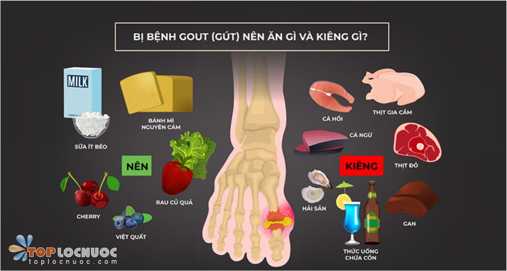 Bệnh gout nên ăn gì và kiêng gì? Thực đơn tốt cho người bị gout