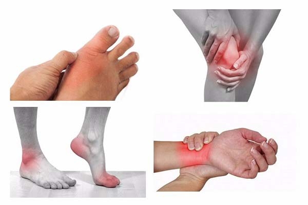 Bệnh gout nên ăn gì và kiêng gì? Thực đơn tốt cho người bị gout
