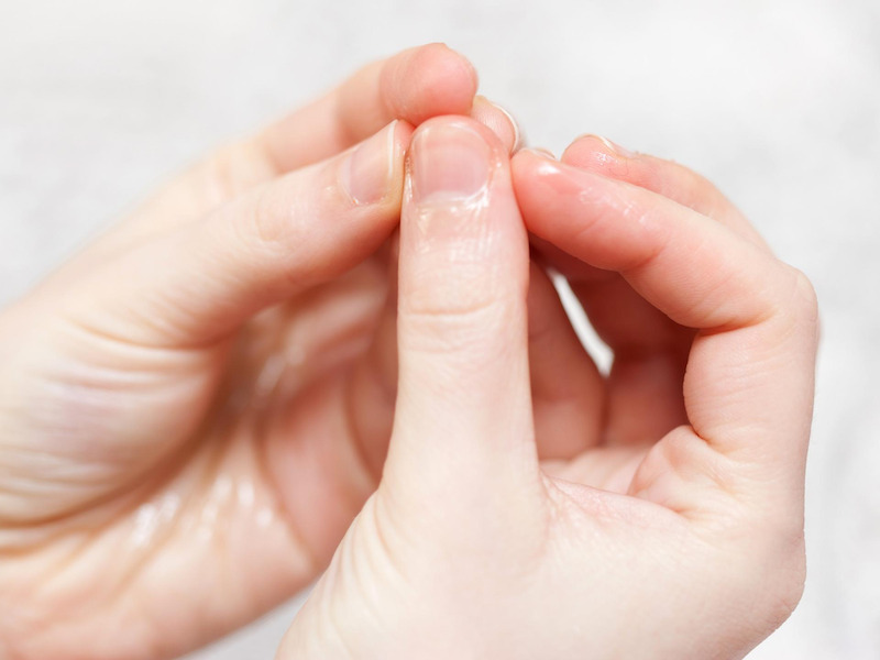 Móng tay bong tróc có thể là dấu hiệu của bệnh vảy nến