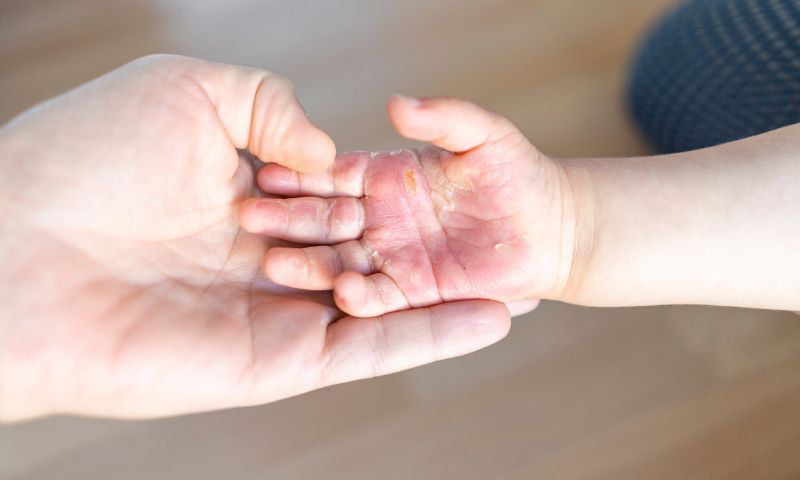 Các đồ gia dụng trong ngôi nhà của bạn cũng tiềm ẩn nguy cơ gây bỏng, nếu sử dụng không đúng cách, không an toàn