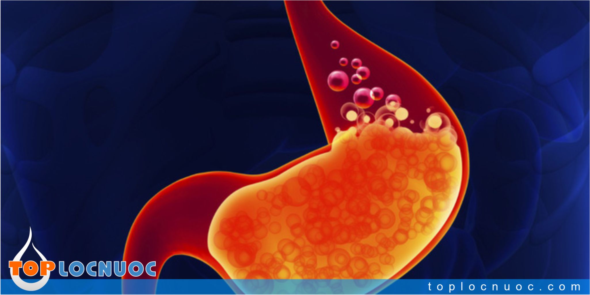 Bật mí 3 cách ngăn ngừa chứng ợ chua, giảm axit dạ dày