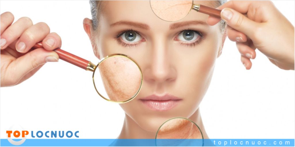 Dấu hiệu đặc trưng cảnh báo cơ thể bạn đang bị mất nước