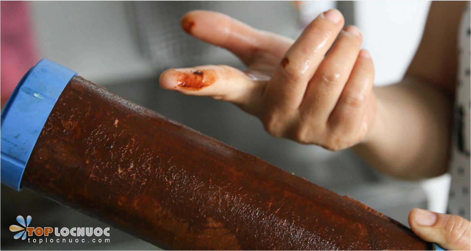 Tự vệ sinh lõi lọc có làm tăng nguy cơ nhiễm khuẩn nước?