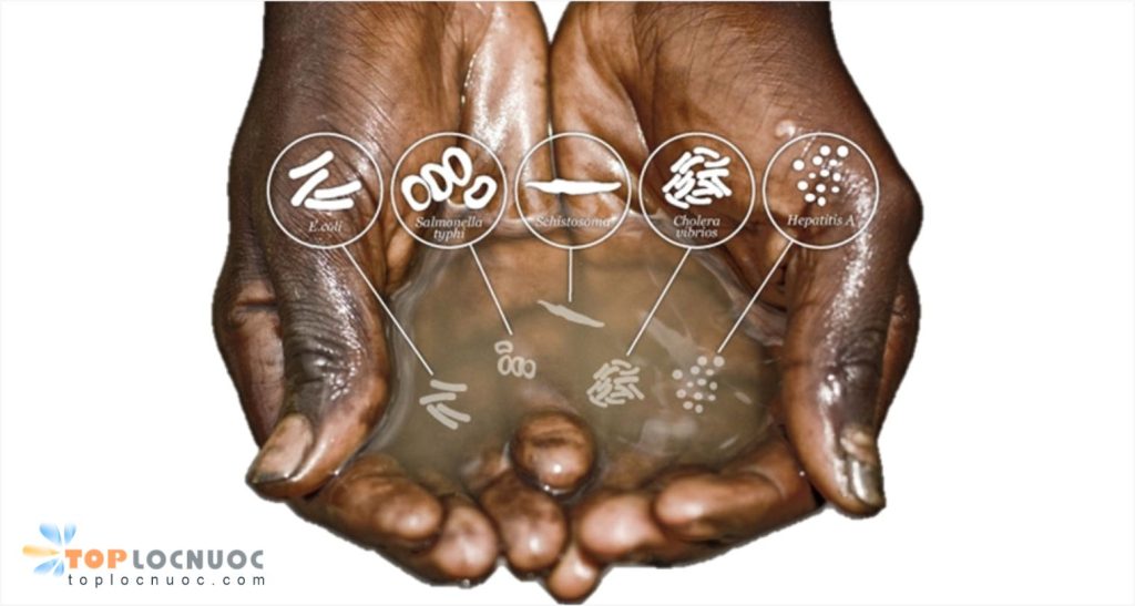 5 Bệnh nguy hiểm thường gặp nhất do nguồn nước ô nhiễm