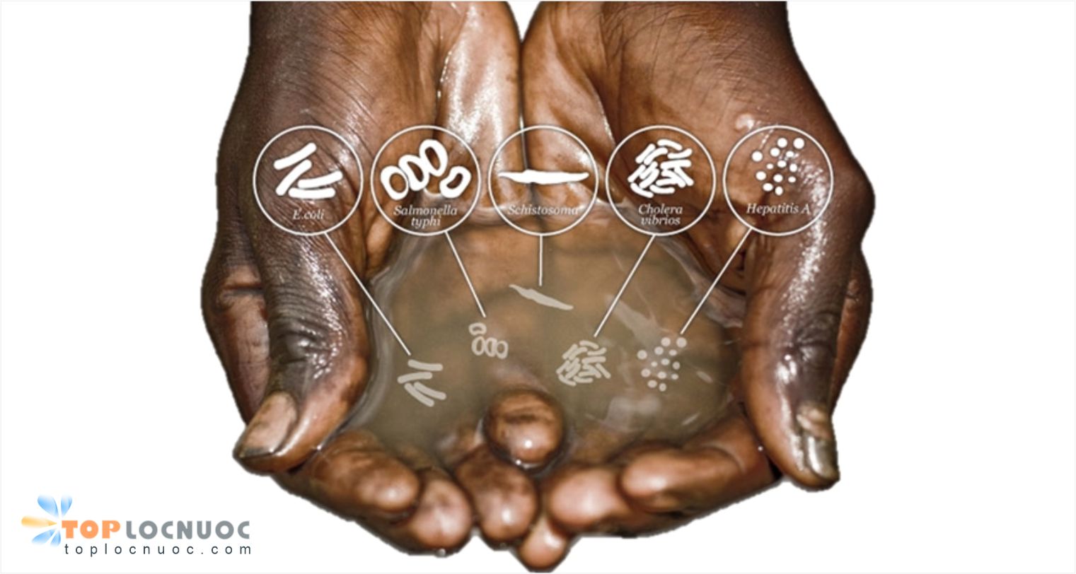 5 Bệnh nguy hiểm thường gặp nhất do nguồn nước ô nhiễm
