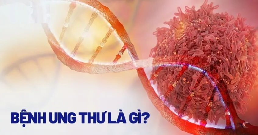 Virus gây ung thư là gì? Điểm danh các loại vi rút gây ung thư thường gặp