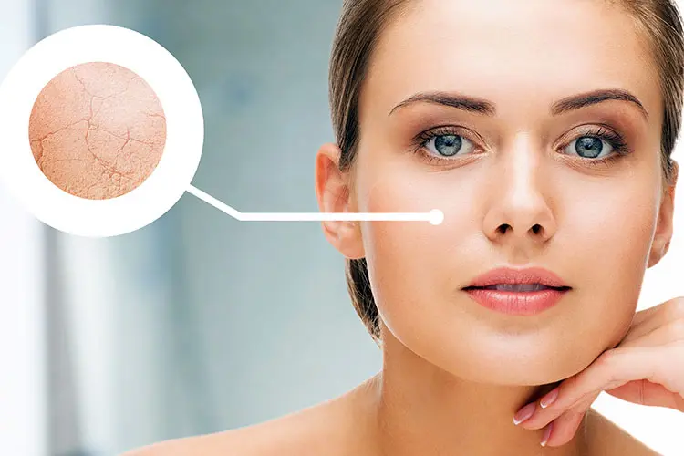 Mất nước là gì? Phân độ mất nước và cách điều trị mất nước