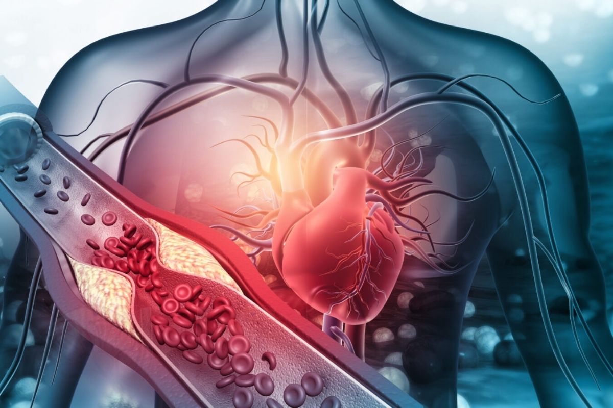 Bệnh nhân tim mạch có thể hỗ trợ điều trị bằng nước điện giải