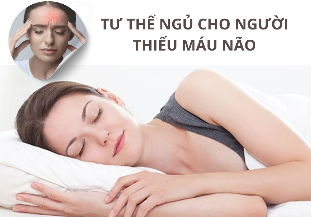 Tư thế ngủ cho người thiếu máu não hiệu quả để cải thiện sức khỏe