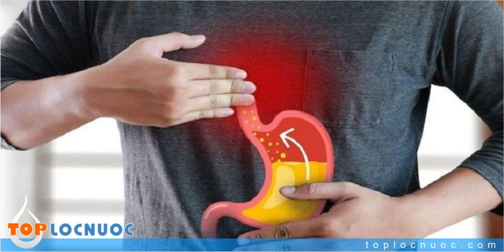 Nước ion kiềm có vai trò gì với người bị đau dạ dày?