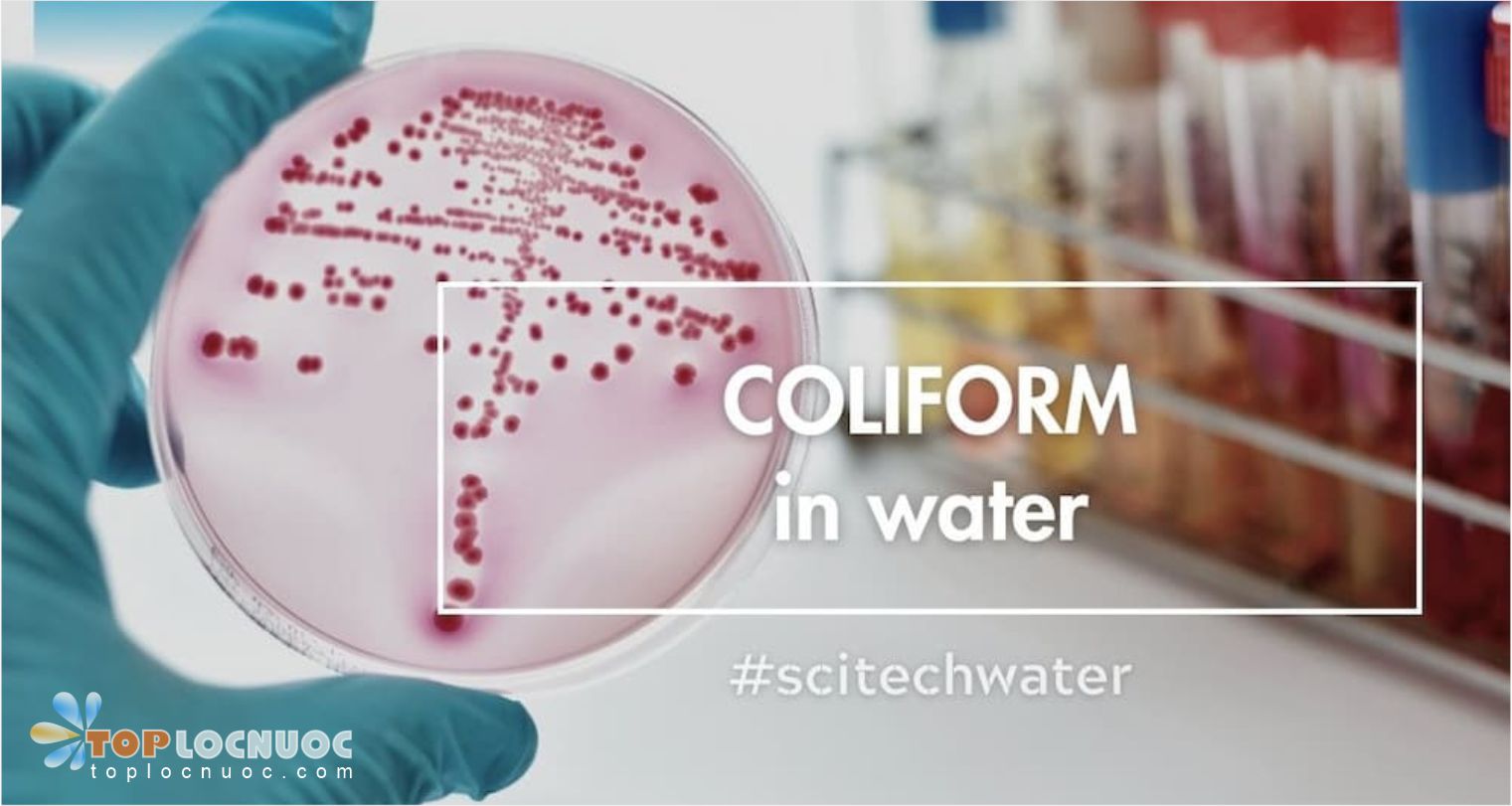 Những vi sinh vật trong nguồn nước gây ra tác hại gì cho sức khỏe?