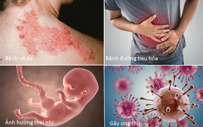Những bệnh dịch phát sinh từ nguồn nước bị ô nhiễm