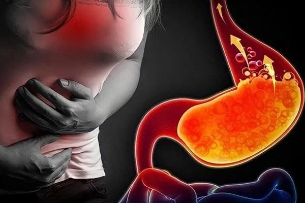 Cơ thể dư axit có triệu chứng gì, làm sao để tránh?