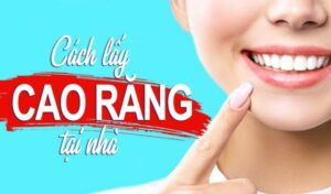 Làm sạch cao răng tại nhà không tốn kém chỉ trong 10 phút