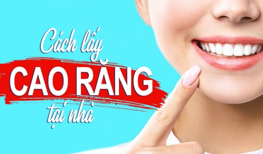 Làm sạch cao răng tại nhà không tốn kém chỉ trong 10 phút