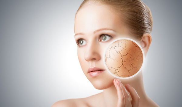 3 Cách chữa da khô nứt nẻ vào mùa đông đơn giản và tiết kiệm