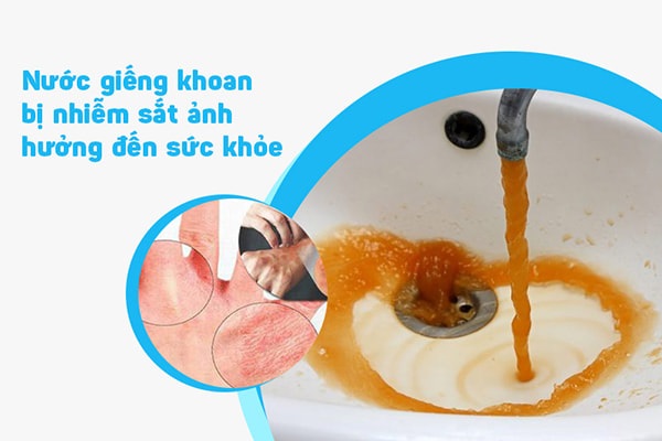 Cách xử lý nước giếng khoan bị đục, có màu vàng và mùi tanh